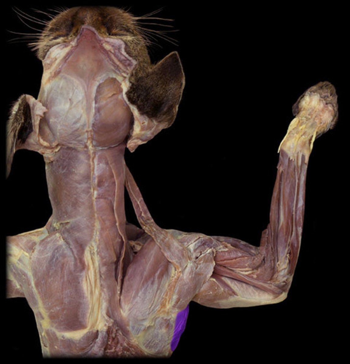 <p>name this muscle</p>