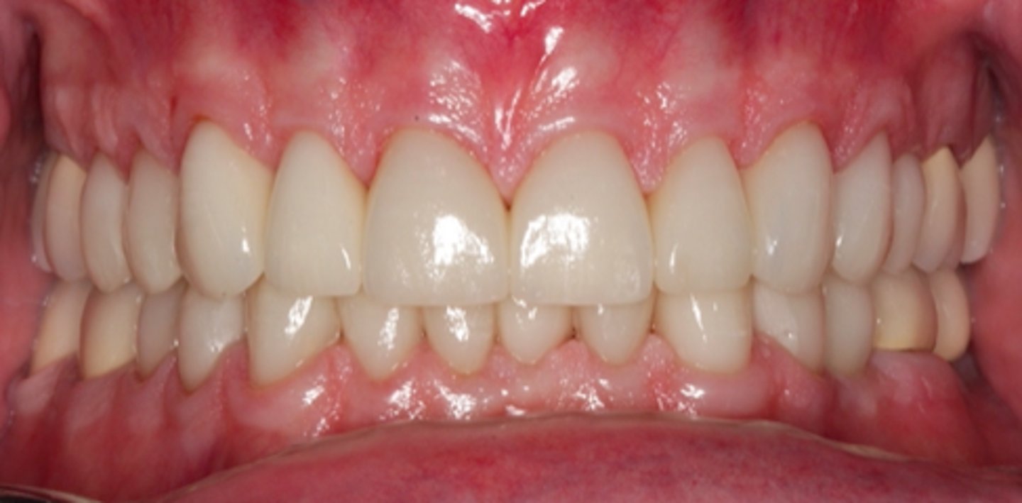 <p>ID the mandibular movement/position</p>