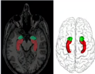 <p>How does the Amygdala relate to fear? (amygdala in green)</p>