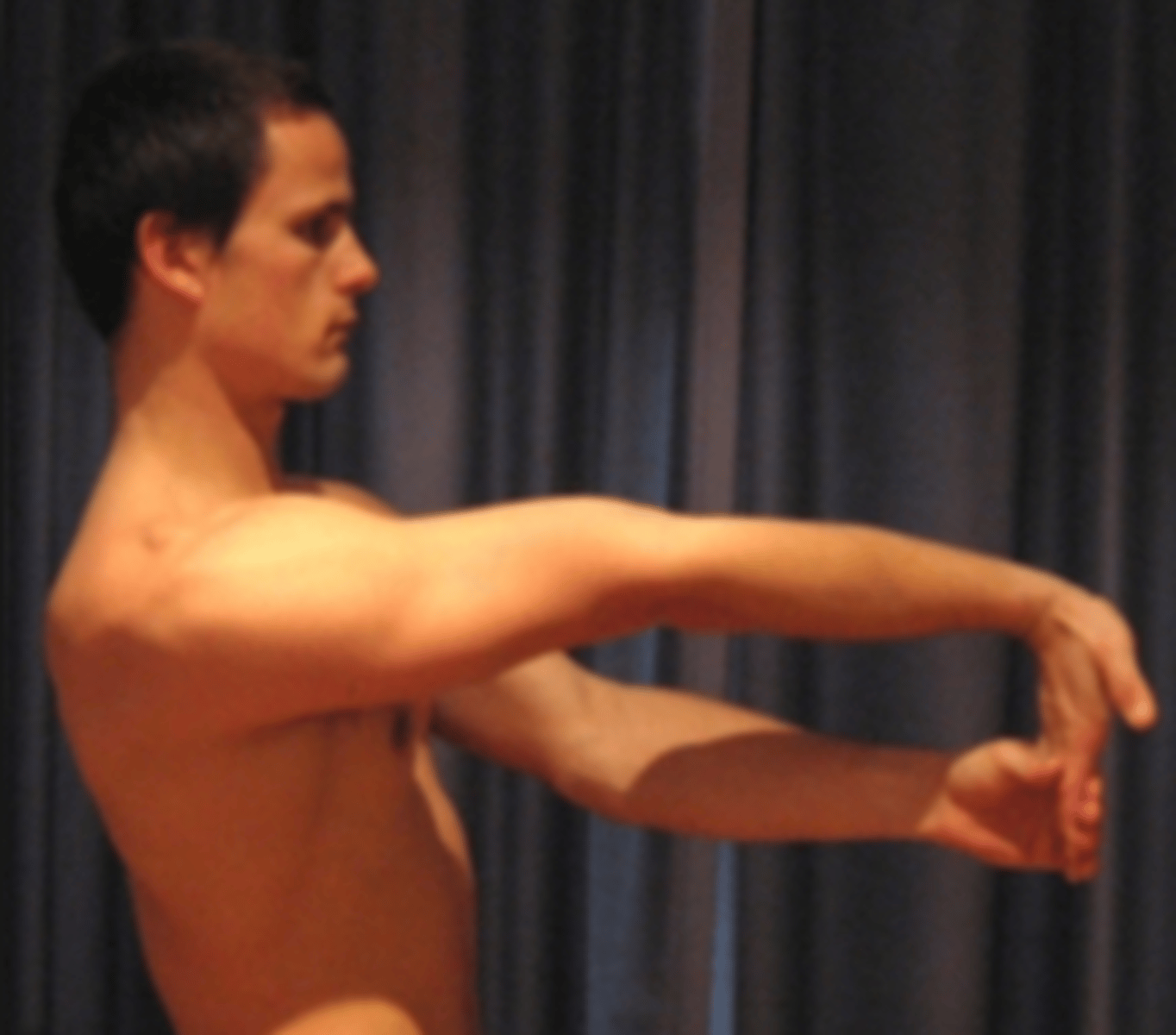<p>Golfers elbow/medial epicondylosis</p>