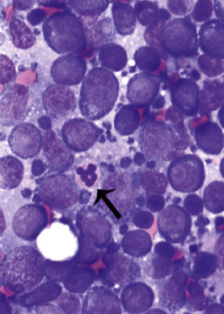 <p>- Histologic grade (low, mid, high) and histologic subtypes (~25 subtypes of canine lymphoma)</p><p>- Immunophenotype (B cell vs. T cell lymphocyte origin)</p><p>- Anatomic site</p>