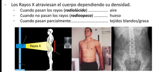 <ul><li><p>Atraviesan los cuerpos, según la densidad o composición</p></li><li><p><strong>Cuando pasa con más facilidad: Radiolúcido</strong></p></li><li><p><strong>Cuando no pasa: Radioopaco</strong></p></li><li><p>Cuando pasa parcialmente: Gris oscuro o claro</p></li></ul><p></p>