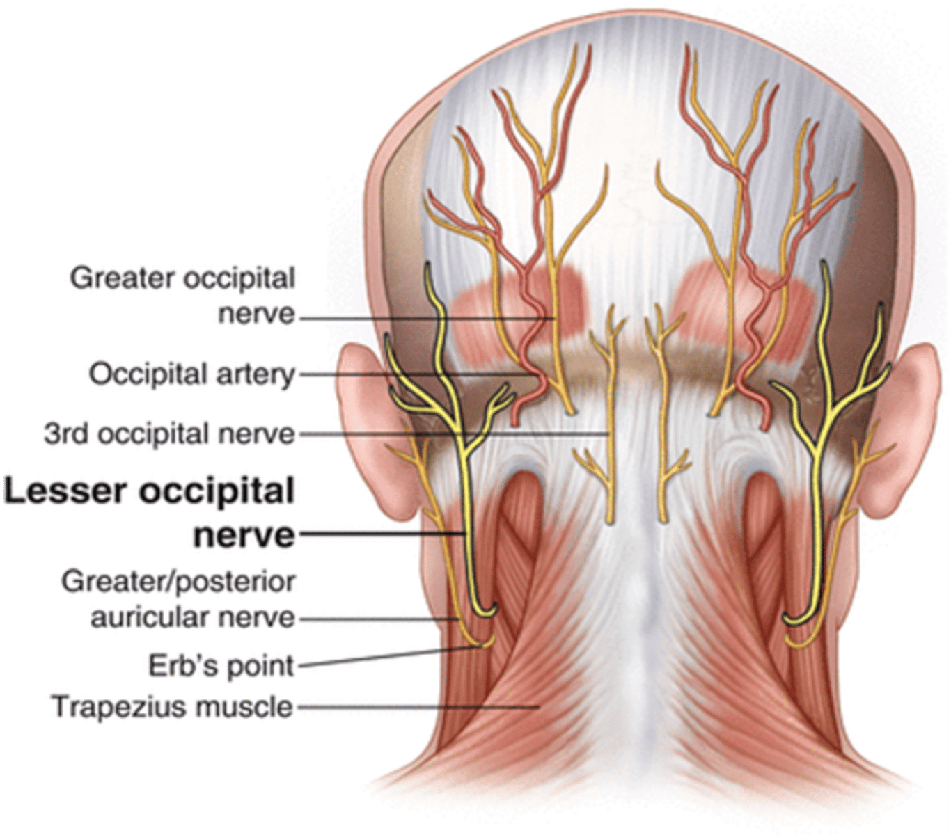 <p>Posterior ethmoidal sinus</p>