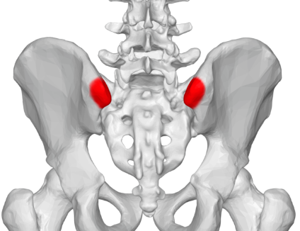 <p>posterior to auricular surface</p>