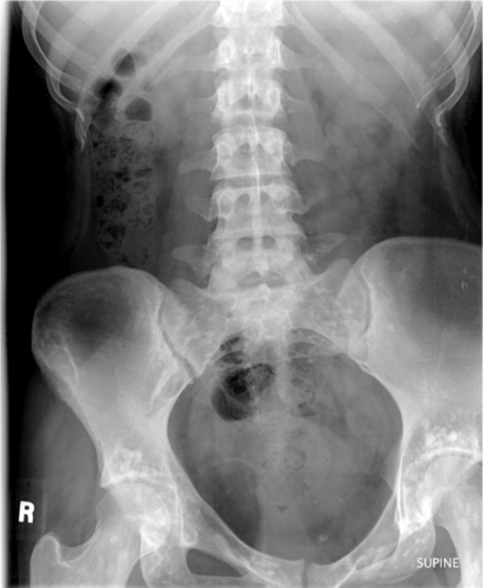 <p>Diagnosis?</p>