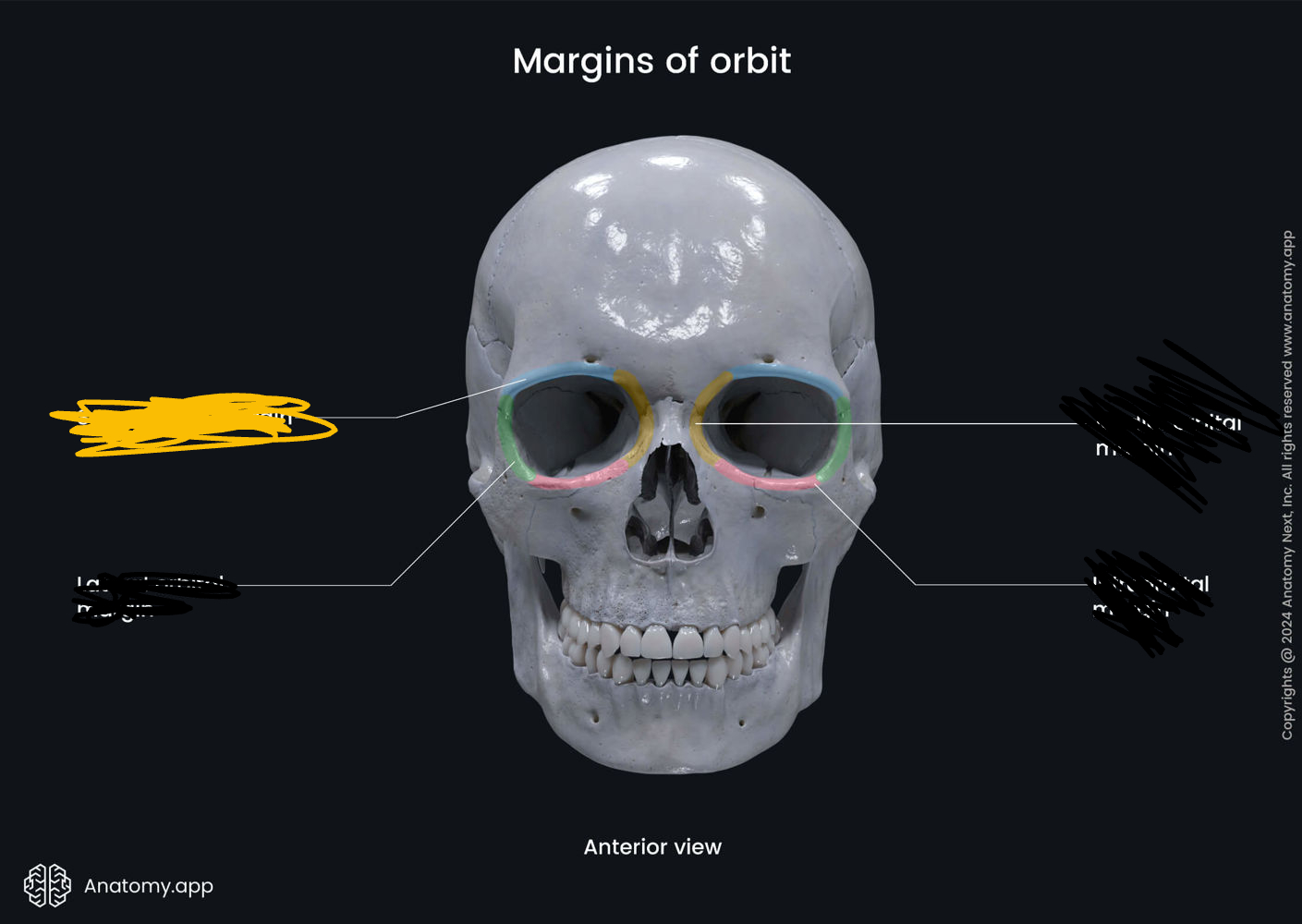 <p>bony marking?</p>