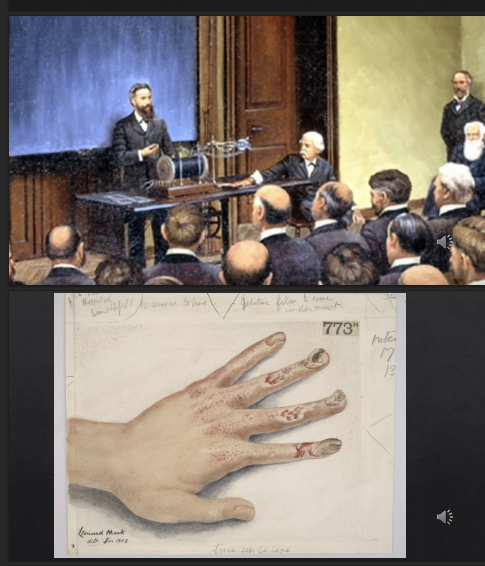 <p>what is a deterministic effect?</p>