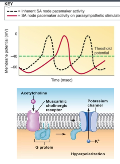 <p>-vagus nerve goes to heart, releases Ach on muscarinic receptors on autorhythmic cells</p><p>-binding activates GPCR, which opens a K+ VGC</p><p>-now K+ leaves cell, cell becomes more neg (hyperpolarize)</p><p>-cell is now further from threshold = harder to reach = reach less often = slower HR</p>