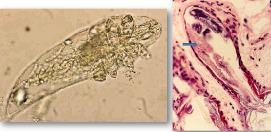 <p>many species, host specific - highly evolved to occupy hair follicles, feed on dead skin</p><p>dermdex canis - dogs</p><p>dermodex cati and demodex gatoi - cats&nbsp;</p><p></p>