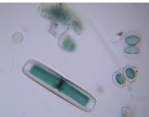 <p>Identify the stramenophile</p>