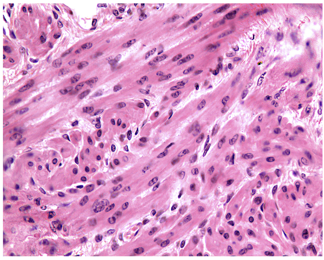 <p>Name the tissue.</p>