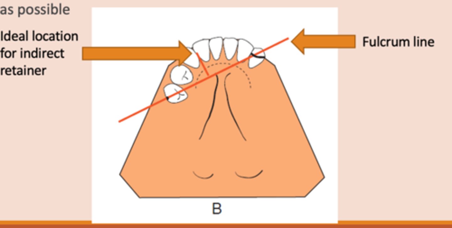 <p>An indirect retainer Ideally should be _______ from primary fulcrum line midway between the most distal rests, as far from fulcrum line as possible</p>