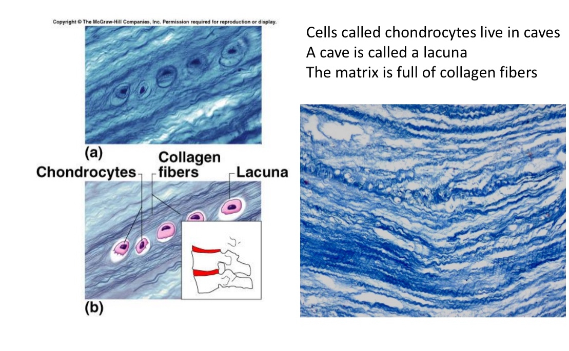 <ul><li><p>Chondrocytes</p><ul><li><p>produces collagen fibers </p></li></ul></li><li><p>Location; intervertebral discs</p></li></ul><p></p>