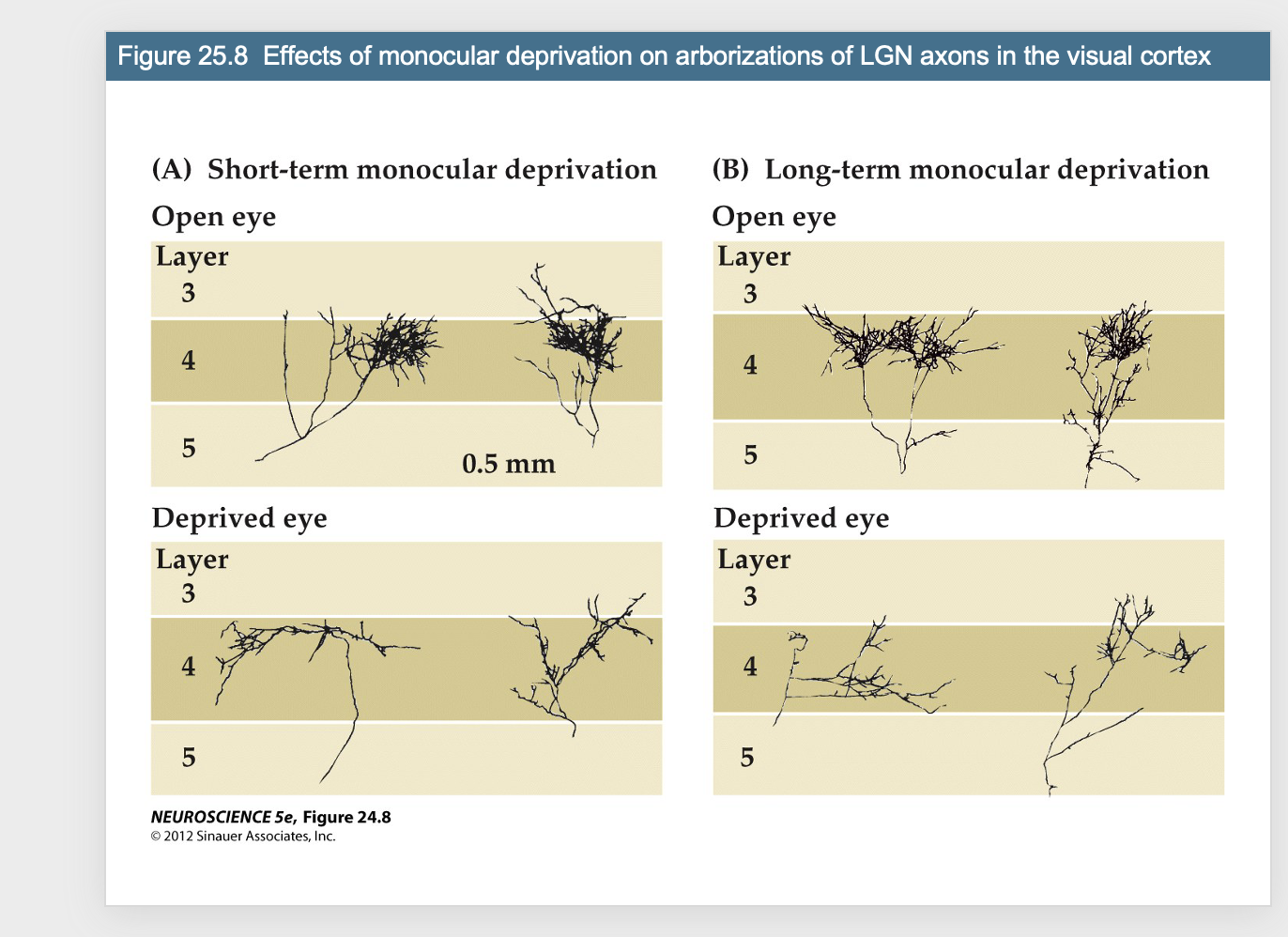 <p>Figure 25.8- Effects of monocular deprivation on arborizations of LGN axons in the visual cortex</p>