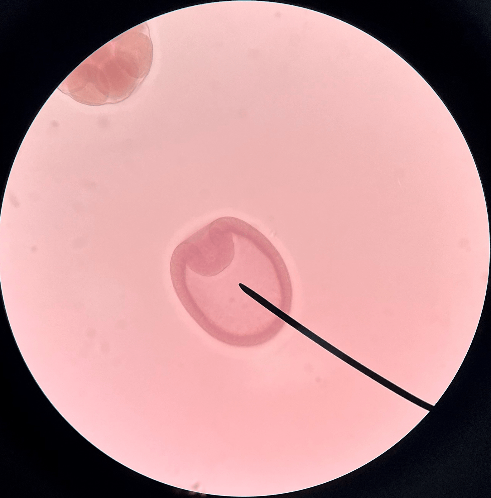 • Slide histology of starfish development.

• The blastocyst is undergoing gastrulation.