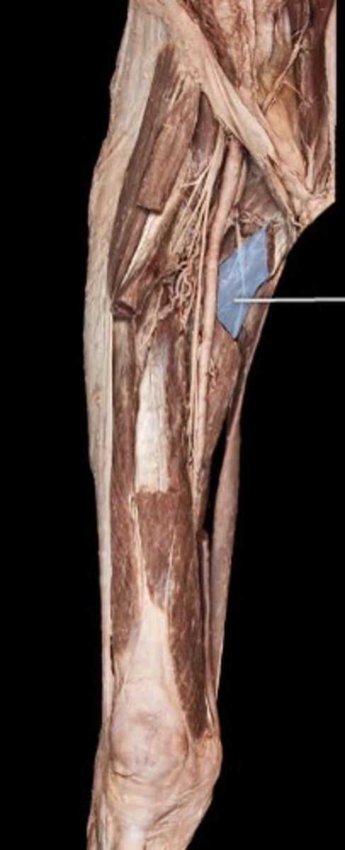 <p>What muscle is this?</p>