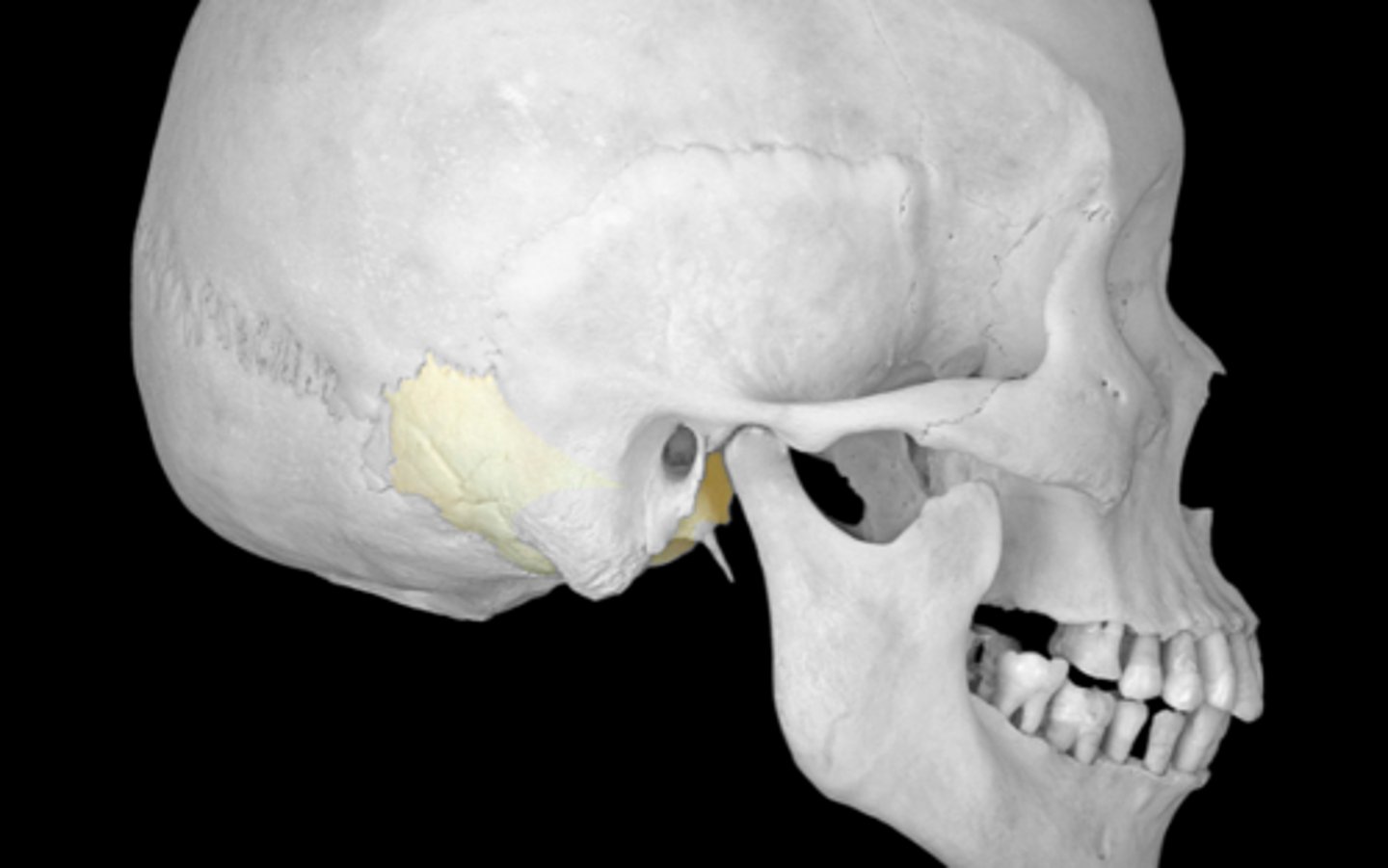 <p>lateral and inferior skull</p>