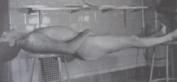 <p>Rigor Mortis (rigidity) </p>