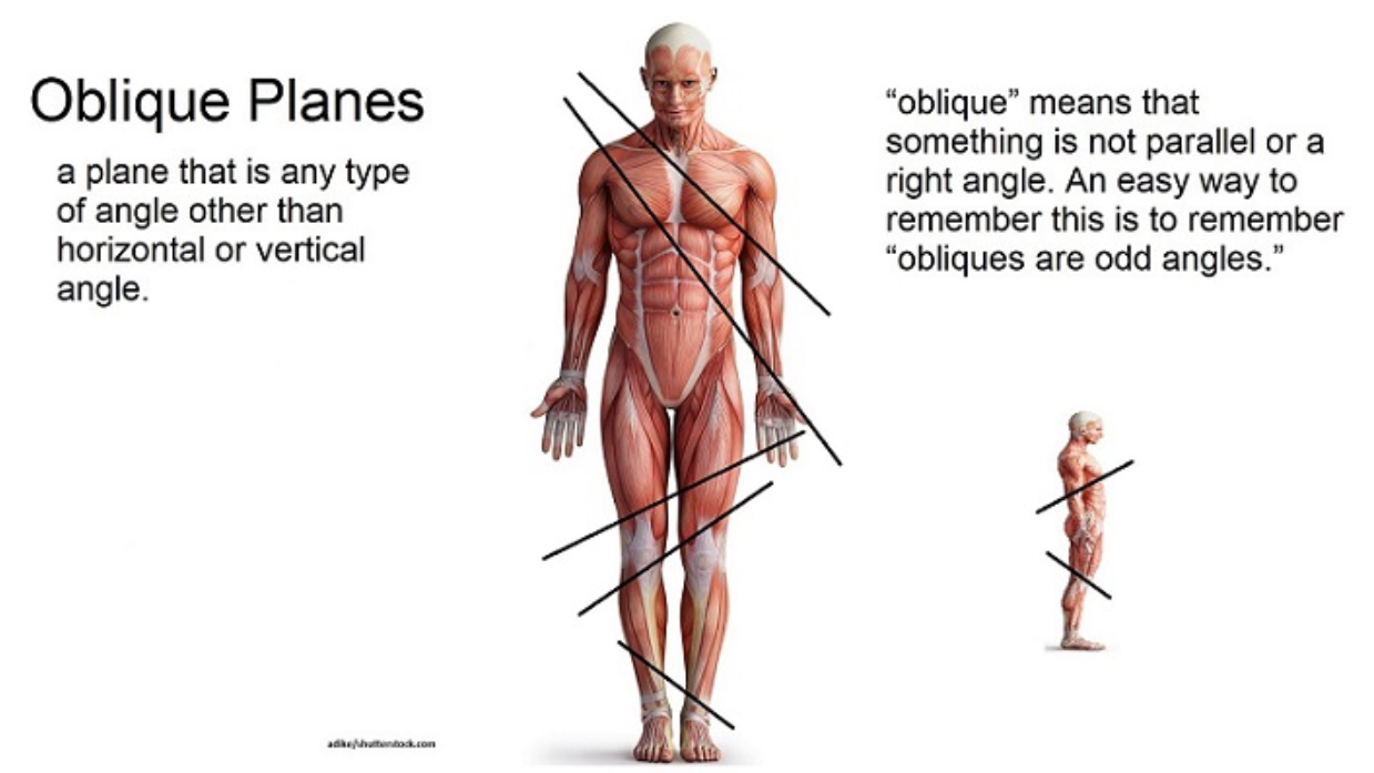 <p>A cut that starts in one plan and ends in different plane (I.e. starts in the coronal and ends in the transverse) </p>