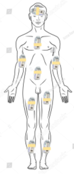 <ol><li><p>TSI: irradiate the whole skin with <strong>electron tx</strong></p></li><li><p>TBI: irradiate the whole body with <strong>MV x-rays</strong></p><p></p></li></ol><p></p>