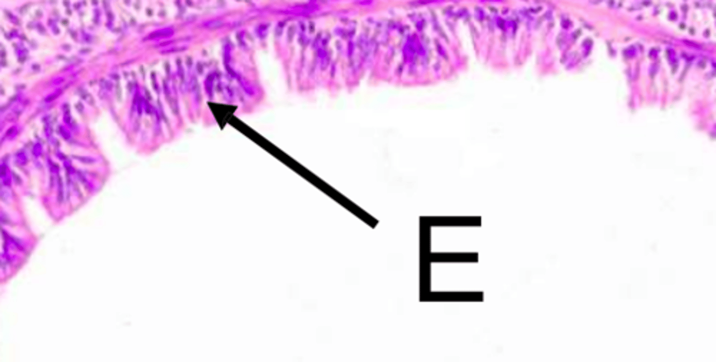 <p>Pseudostratified ciliated columnar epithelium</p>