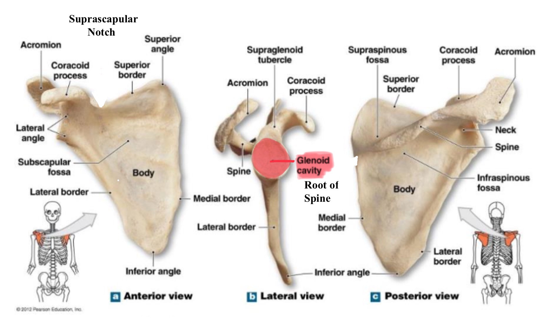 <p>glenoid fossa (cavity)</p>