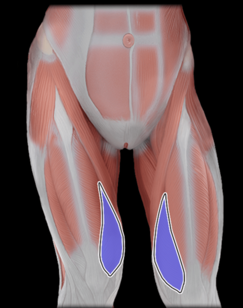 <p>What Muscle Is Highlighted?</p>