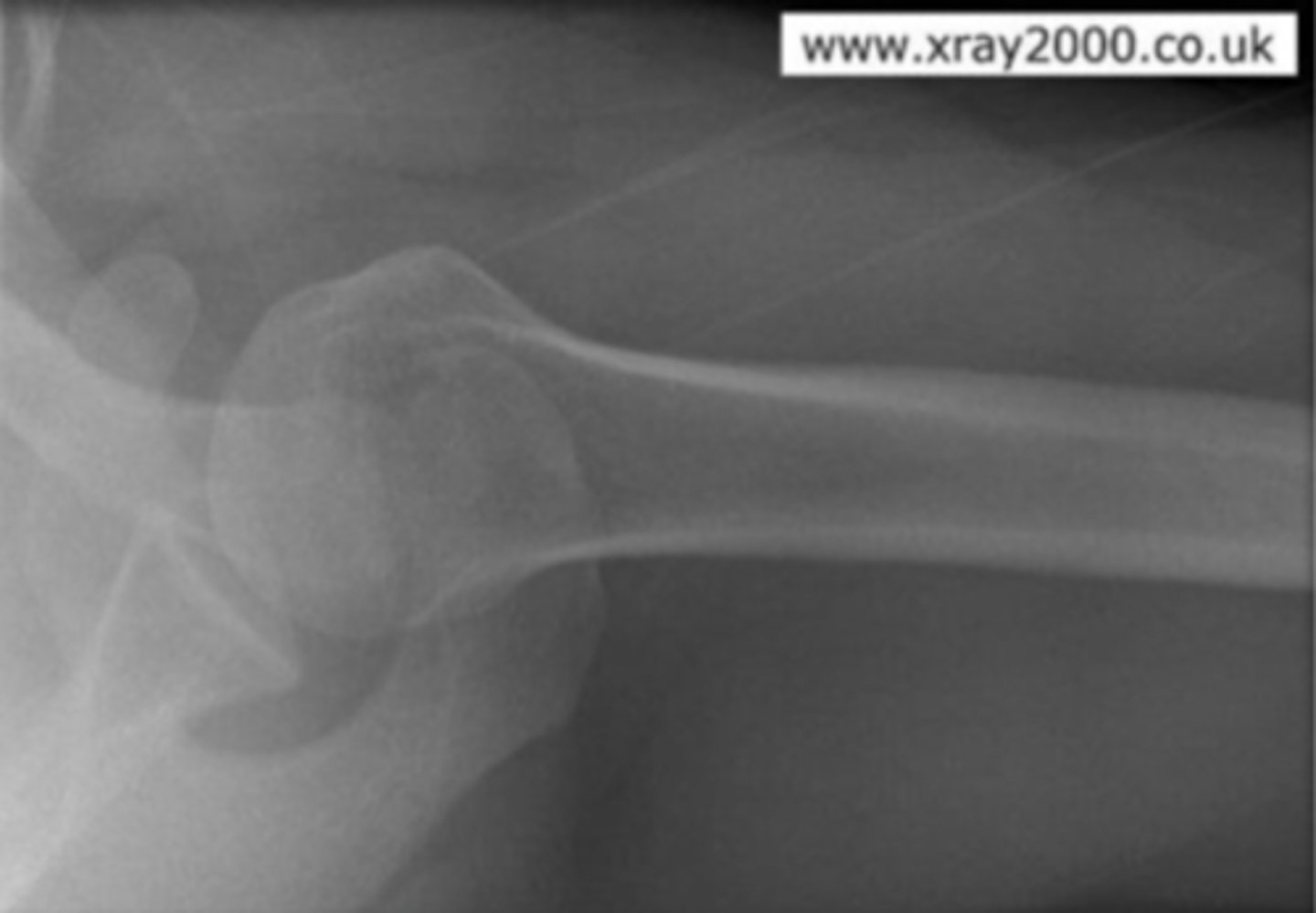 <p>What view is this?</p>