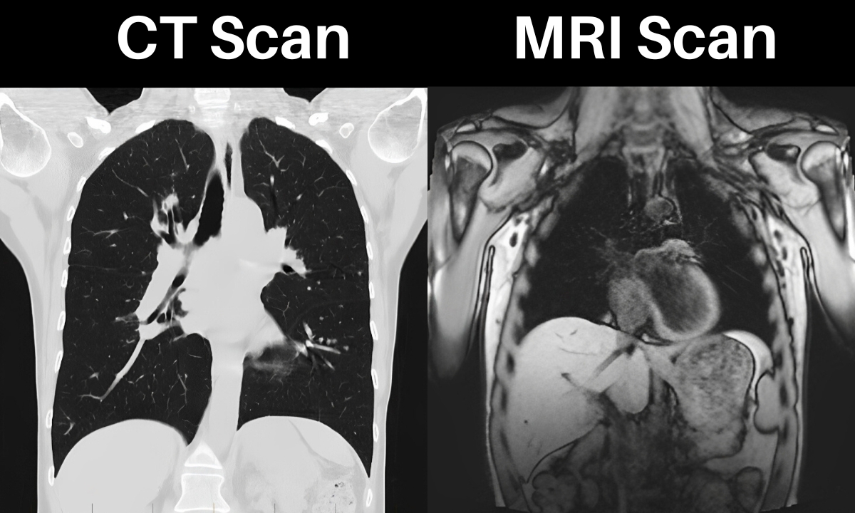 <p> <strong>MRI scan?</strong></p>