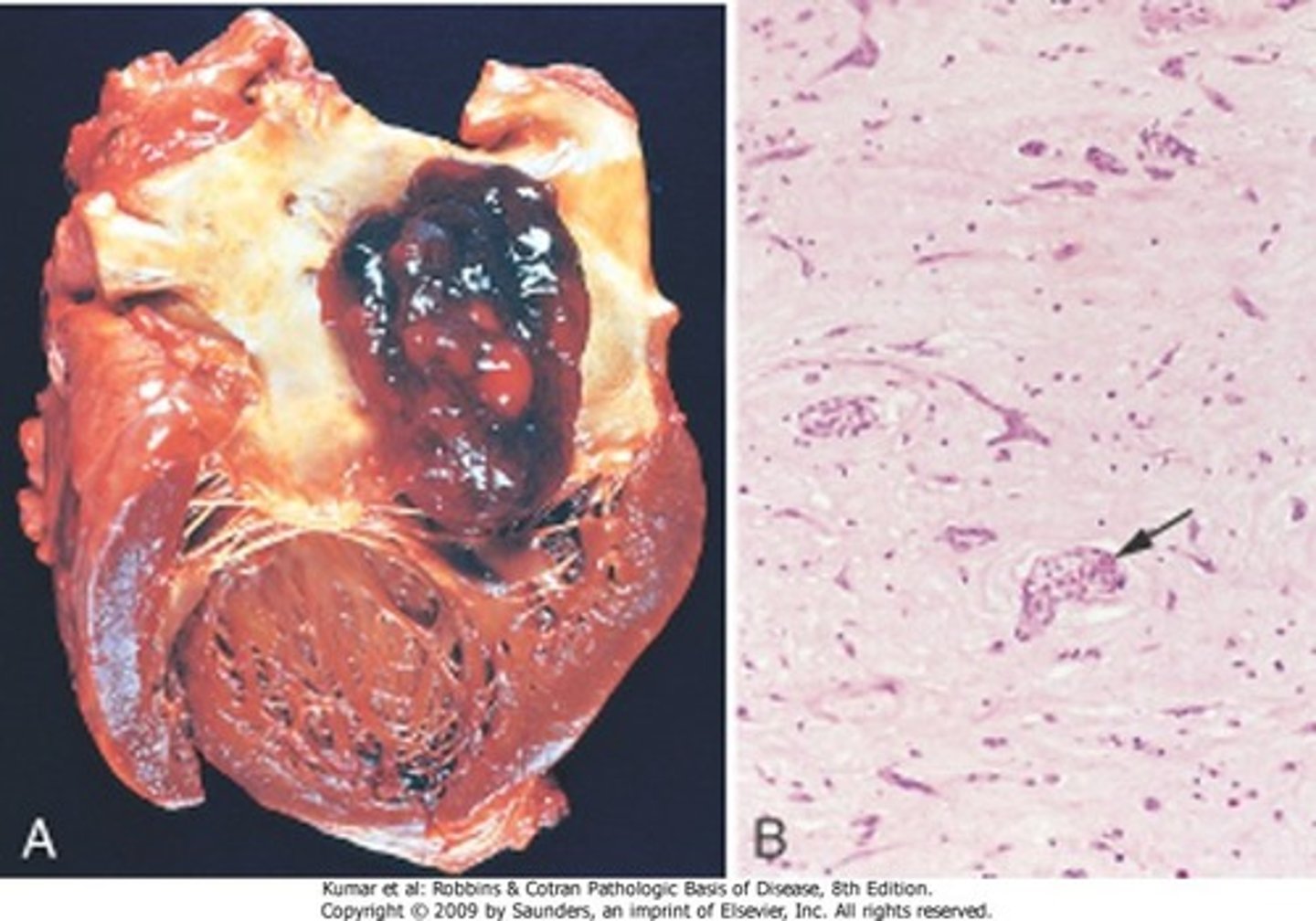 <p>gelatinous appearance</p>