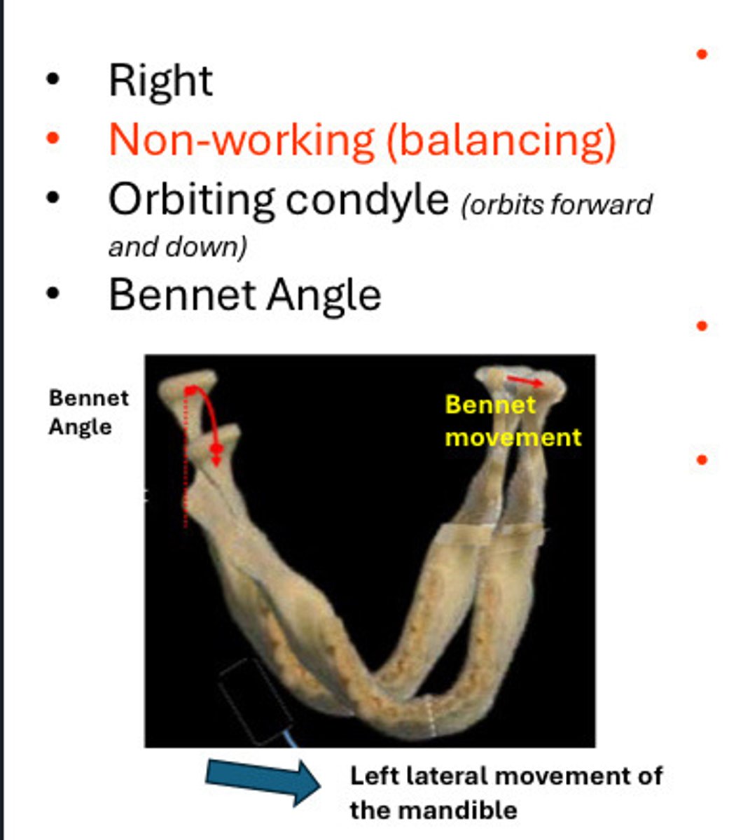 <p>(In this image right side</p><p>contacts. (very desruptive if present)</p>