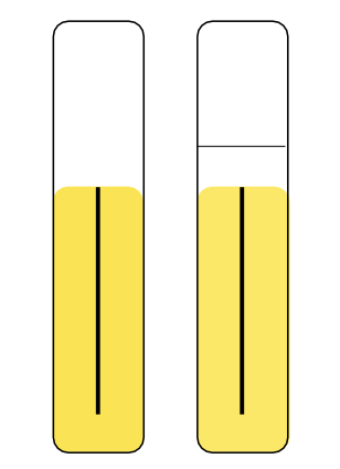 <p>If the aerobic and anaerobic tubes are both yellow, what does that mean?</p>
