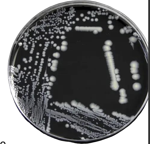 <p>Culture on buffered charcoal yeast extract extract ((BCYE] agar) high in iron and cysteine)</p>