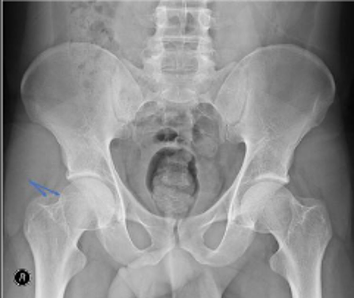 <p>What are the arrows pointing to?</p>