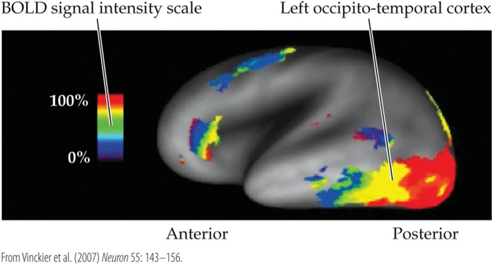 <p><span>The figure shows an fMRI scan of a subject completing a laboratory task. What was the subject most likely doing during the task</span></p>