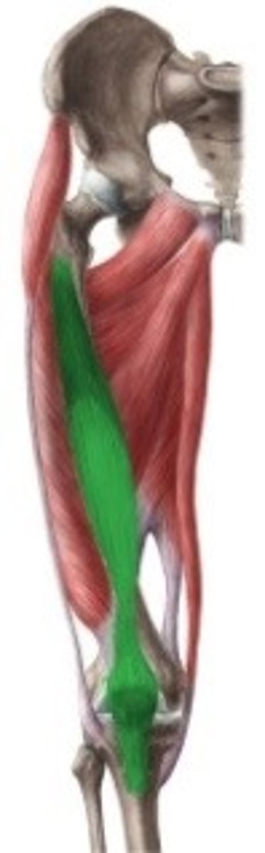 <p>M. quadriceps: vastus intermedius</p><p>O: voorzijde en laterale zijde van</p><p>de femur</p><p>I: basis patella diep van de rectus femoris</p><p>tuberositas tibiae Inn: N. femoralis (L2-L3-L4)</p>