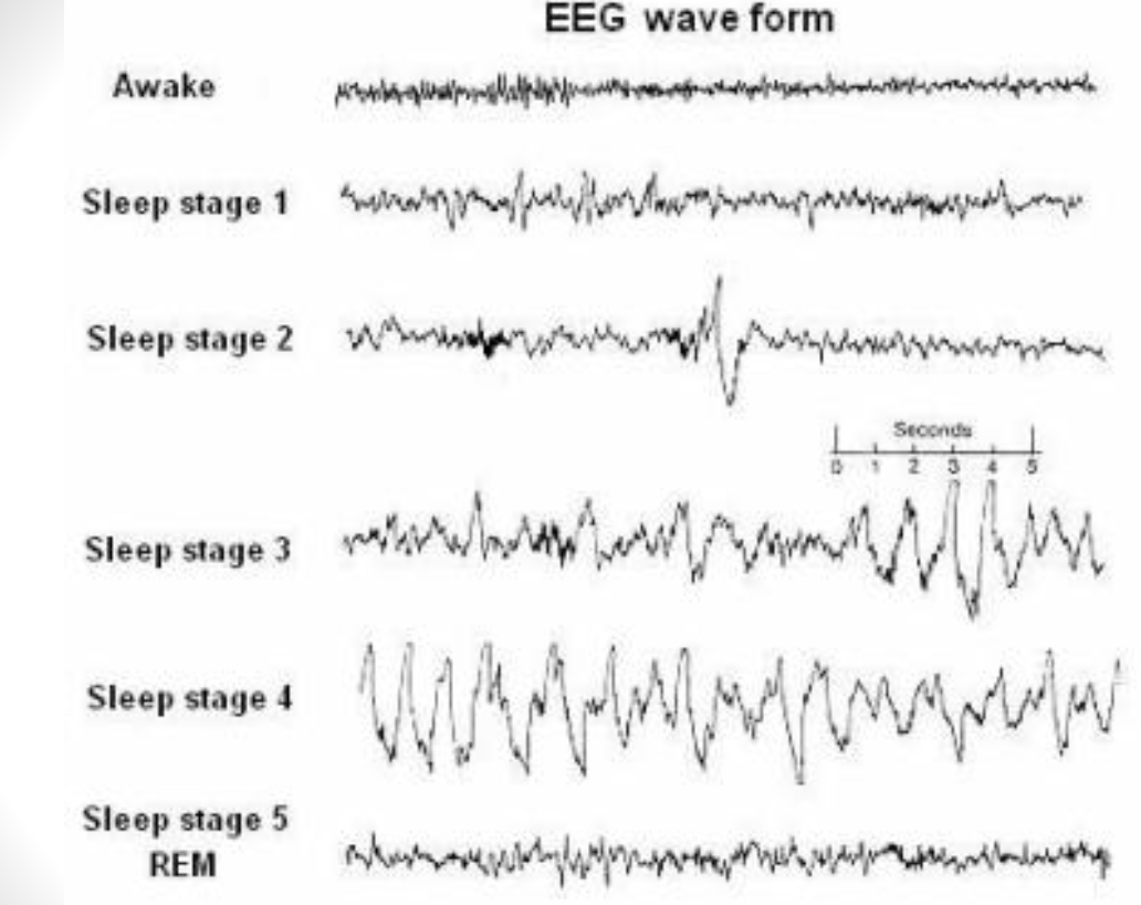 <ul><li><p>EEG doesn’t produce images BUT produces electrical waves to see how brain is functioning</p><ul><li><p>Can be monitored during sleep</p></li><li><p>different brain waves during different times of the night</p></li><li><p>indicates brain activity → shorter the amplitude/wavelength, the more alert/awake you are</p></li></ul></li></ul><p></p>