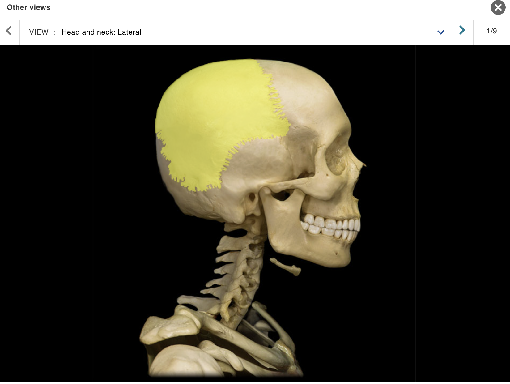 <p>Location:</p><p class="p1">• Skull (lateral)</p><p class="p1">Description:</p><ul><li><p>﻿﻿Paired, flat bone</p></li><li><p>﻿﻿Forms most of lateral skull</p></li></ul><p class="p1">Comment:</p><ul><li><p>﻿﻿Parietal bones articulate at sagittal suture (midline)</p></li><li><p>﻿﻿Articulates with frontal bone at coronal suture, occipital bone at lambdoid suture, and temporal bone at squamosal suture</p></li></ul><p></p>
