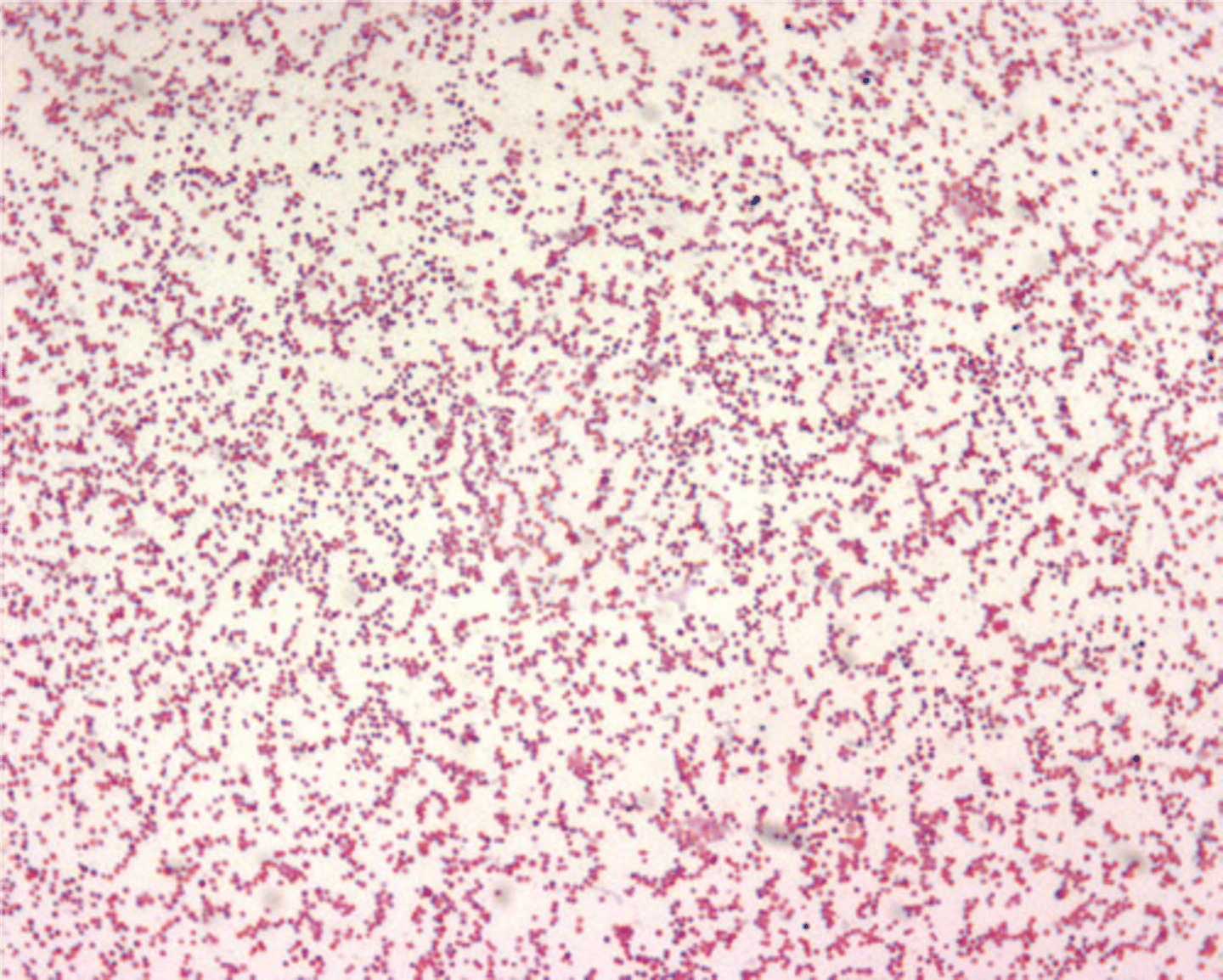<p>Gram negative coccobacilli</p>