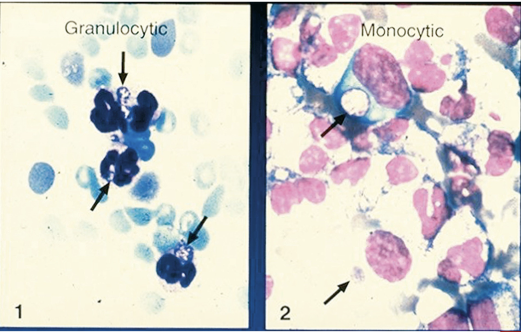 <ul><li><p>Cause disease in wild and domesticated animals, especially dogs, and humans</p></li><li><p> Tick is the vector</p></li><li><p> Organisms parasitize macrophages or granulocytes</p></li><li><p> Cause <strong>ehrlichiosis</strong></p><ul><li><p> Disease characterized by leukopenia and thrombocytopenia</p></li><li><p> Organisms enter the WBCs and develop into a cluster known as a morulae</p></li><li><p> Morulae can resemble a berry or blackberry (see Fig 31-7)</p></li></ul></li></ul><p></p>