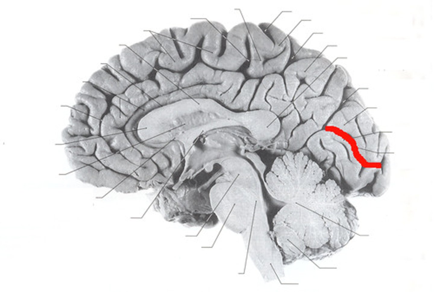<p>separates the occipital lobe into superior and inferior halves</p>