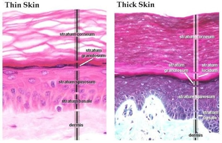 <p>THICK SKIN:</p><p>-hairless, consists of a thick epidermis (w/ 5 strata)</p><p>-soles of feet, palms of hands, surface lining of fingers & toes</p><p>THIN SKIN:</p><p>-contains hair, its thickness varies based on the thickness of the dermis (epidermis has 4 strata).</p><p>-covers rest of body</p>