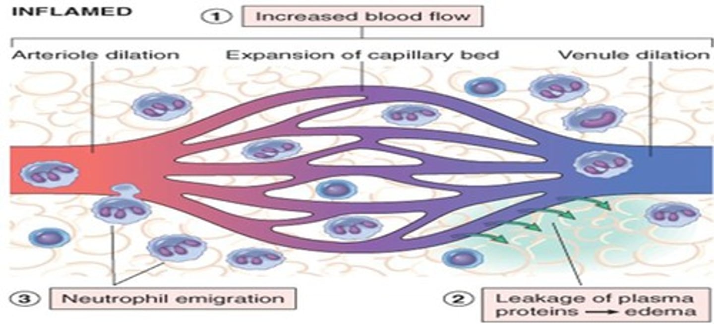 <p>1. Vasodilation</p><p>2. Hyperemia</p><p>3. Increase in capillary permeability</p><p>4. Chemotaxis to attract cells of the immune system</p>