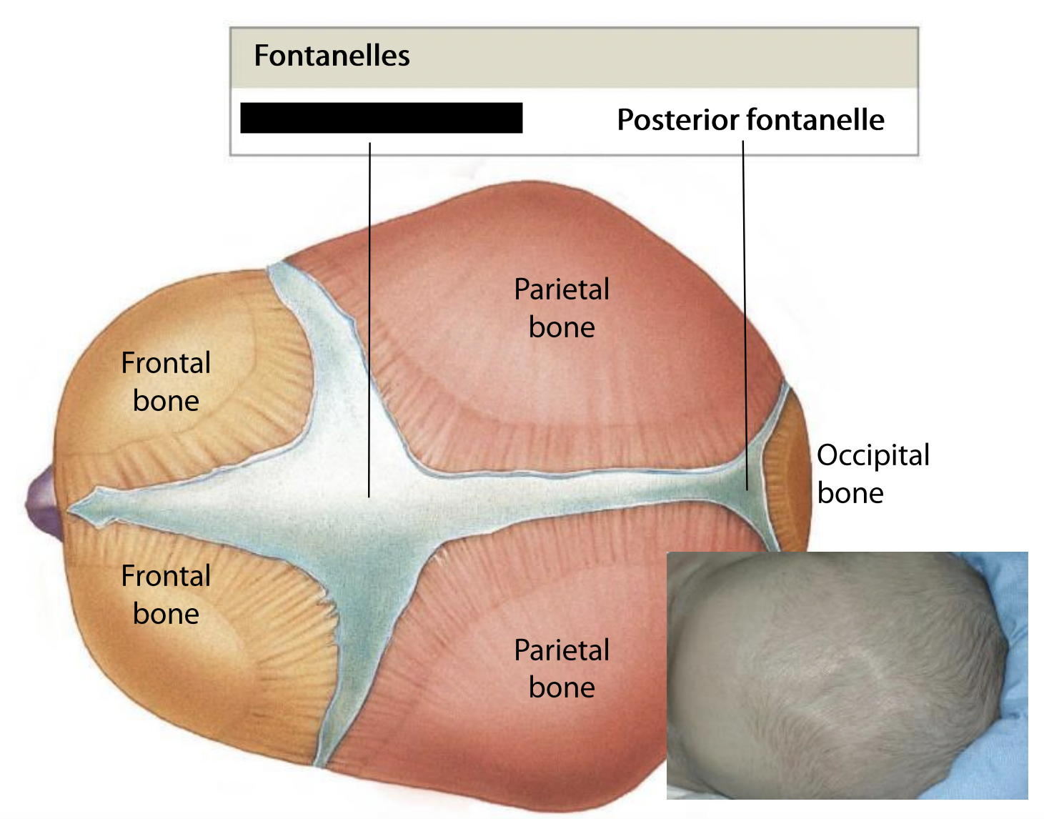 What fontanelle is this?