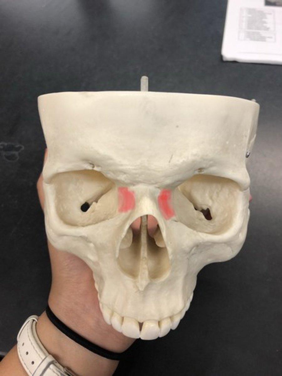 <p>Medial portion of the eye socket</p>