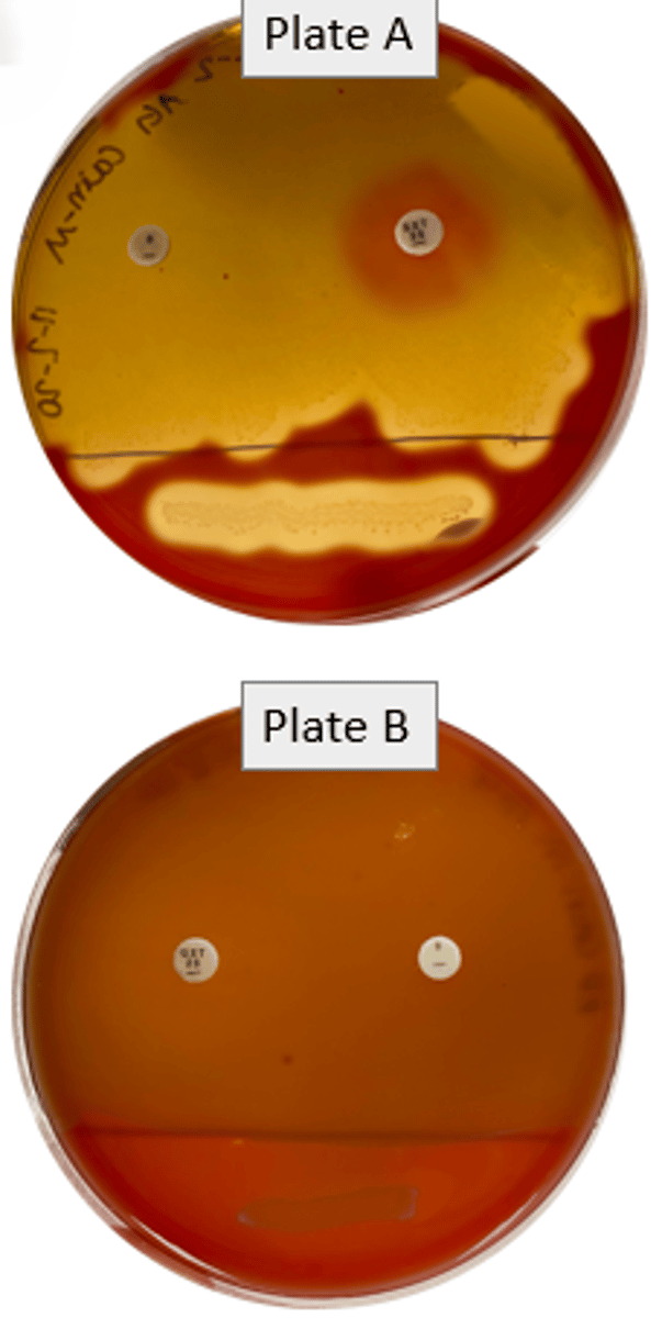 <p>Hemolysis: Beta</p><p>Bacitracin: R</p><p>SXT: S</p>