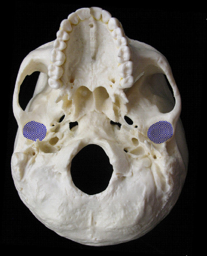 <p>forms temporomandibular joint (TMJ) with mandible</p>