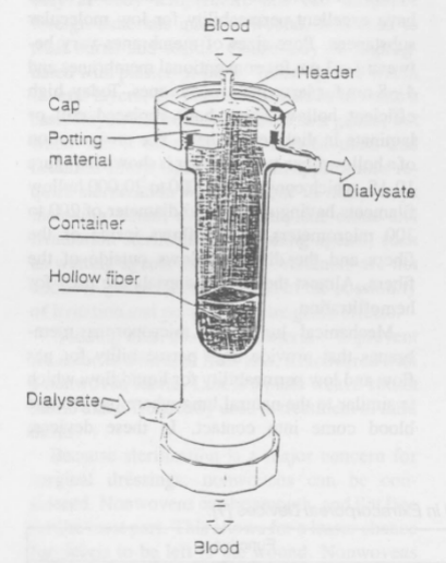 <ul><li><p>High efficient</p></li><li><p>Hollow fibers</p></li><li><p>Blood flows inside of the fibers</p></li><li><p>Dialysate flows outside of the fibers</p></li><li><p>Cleaned blood exits and the used dialysate is discarded</p></li></ul><p></p>