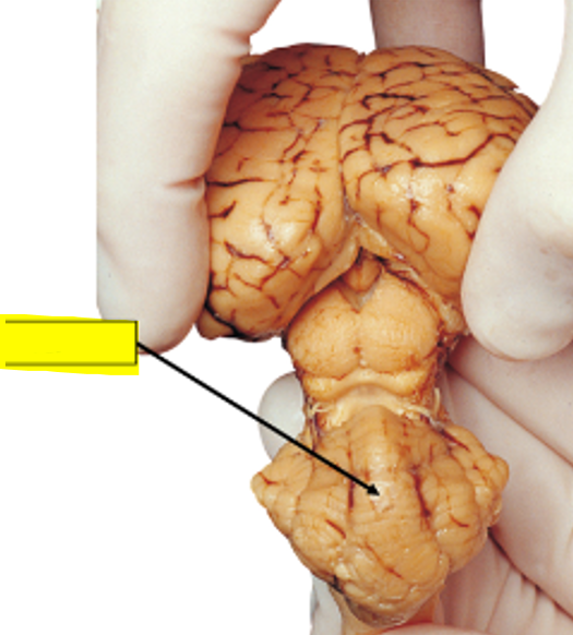 <p>what structure of the sheep brain is highlighted in yellow?</p>