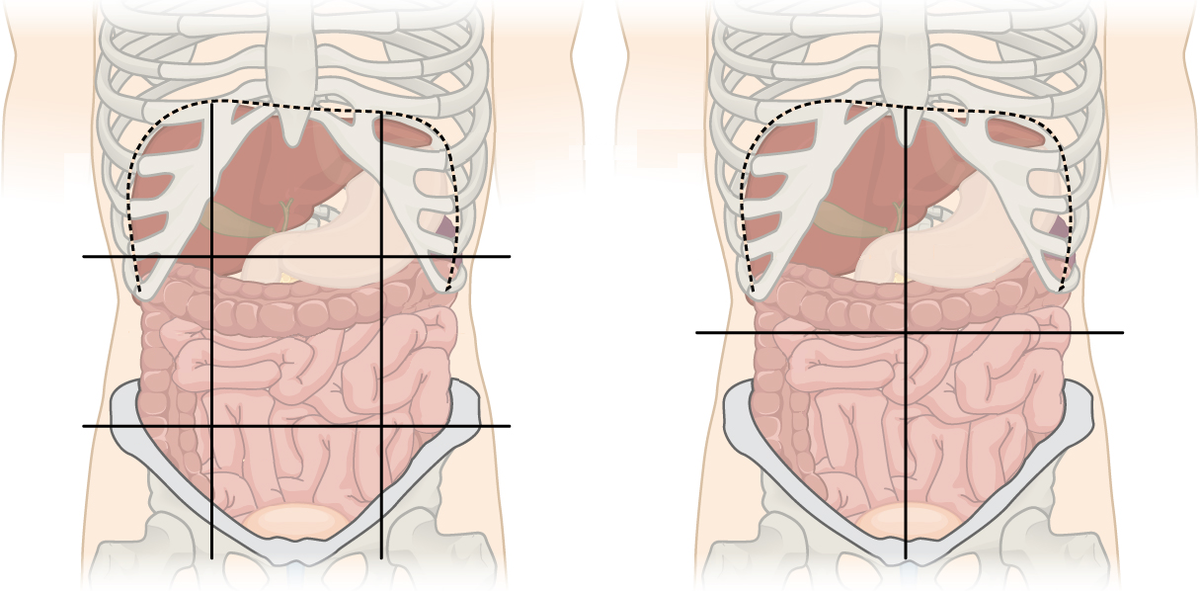 <p>iliac</p>